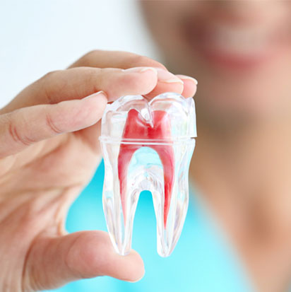 Root Canal in Edgware